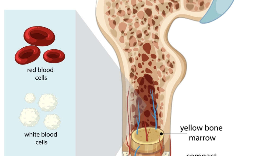 Osteoporosis, bone health