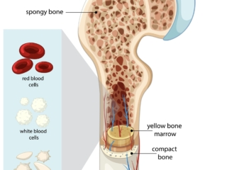 Osteoporosis, bone health