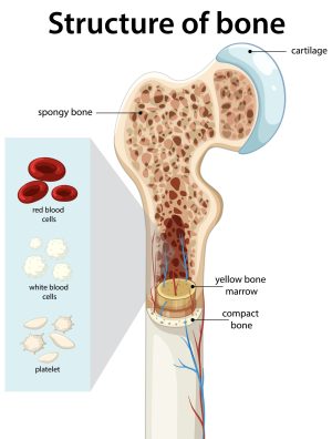 Osteoporosis, bone health