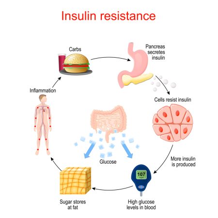 Diagram, cycle, insulin resistance, inflammation, carbs.