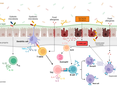 Leaky gut diagram